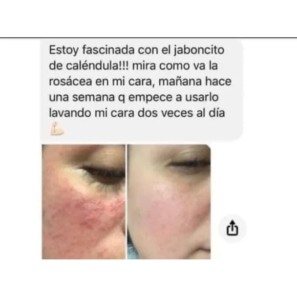 Jabón Caléndula - Picture 5 of 6